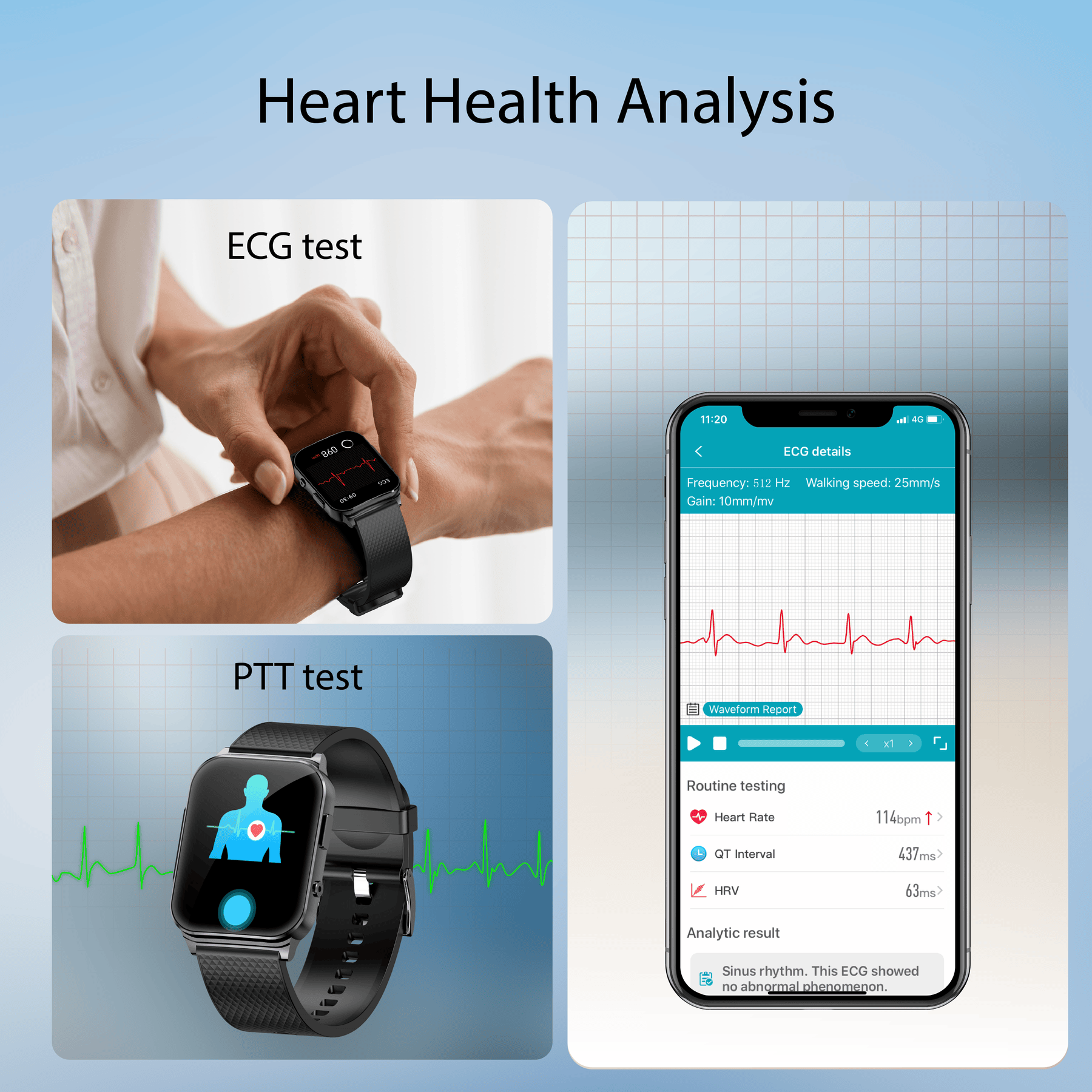 Fitness Tracker Apple Watch Bp Check Watch With Ekg And Blood