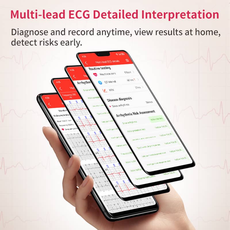 PH02 MULTI-LEAD ECG Monitoring  Blood Glucose Blood Pressure Heart Rate Measurement Health Smart Watch
